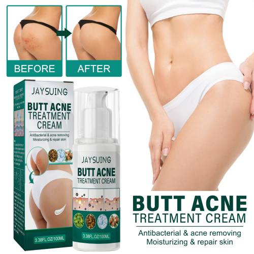 Butt Cream with Shea Butter, Clarifying