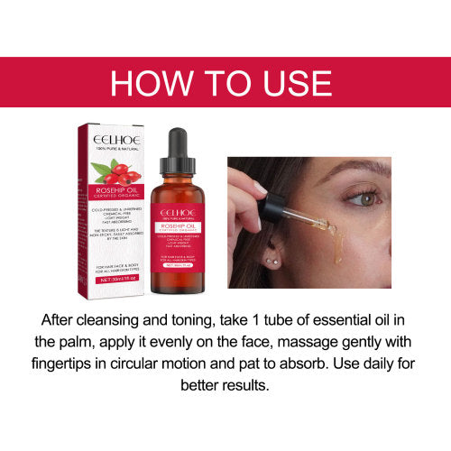 Rosehip Oil for Face, Body & Hair