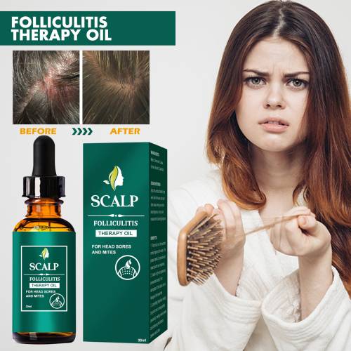 Ginger & Grapeseed Scalp Oil