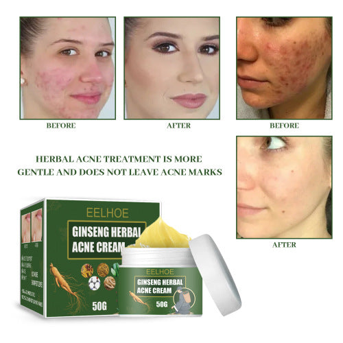 Witch Hazel & Niacinamide Clarifying Face Cream