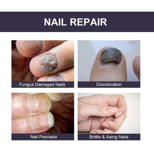 Panthenol Nail Essence