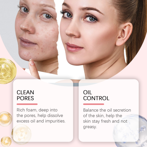 Salicylic Acid Foam Cleanser with Niacinamide & Ceramide
