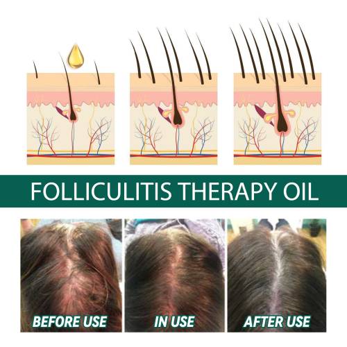 Ginger & Grapeseed Scalp Oil