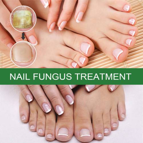 Nail Care Solution for Shiny, Soft Nails