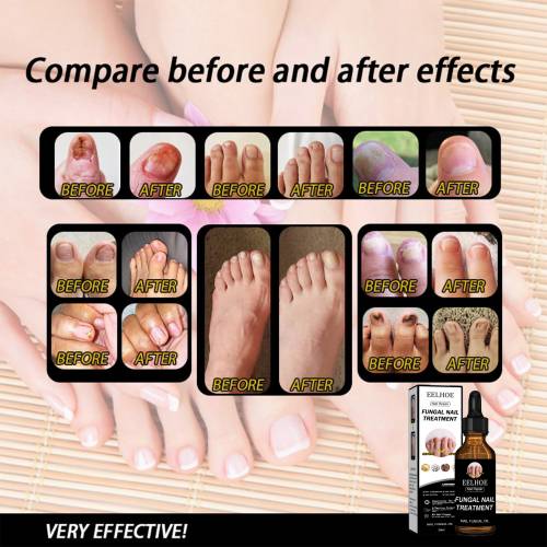 Nail Brightening Solution with Panthenol