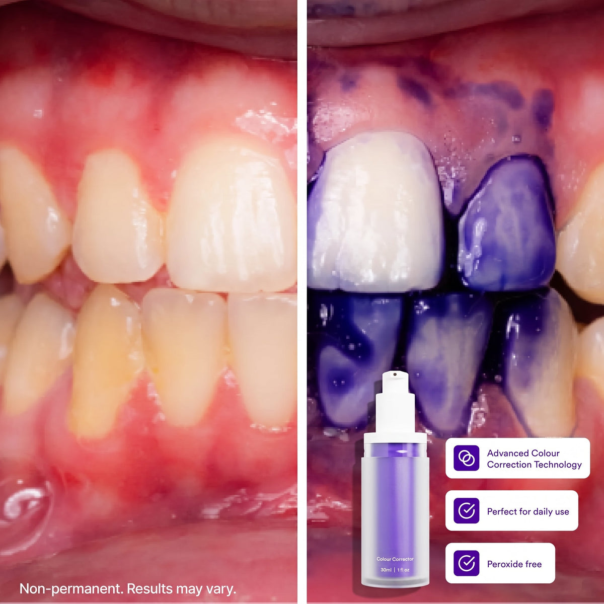 V34 Colour Corrector - Tooth Stain Concealer, Purple Whitening