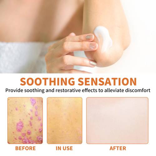 Hand & Foot Skin Cream