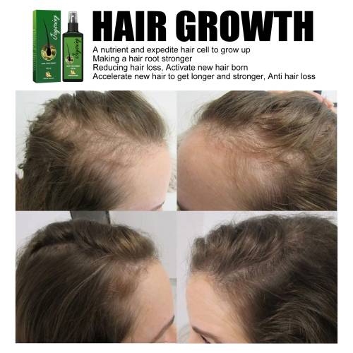 Panthenol Scalp Care Spray