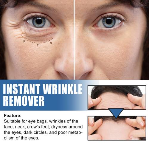 5-Second Instant Wrinkle Cream