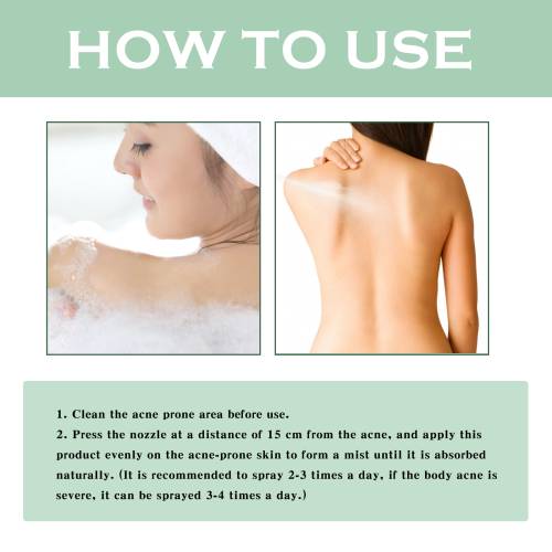 Back & Body Clarifying Spray with Witch Hazel