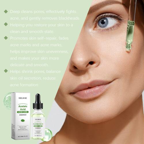 Azelaic Acid Face Essence for Blackheads
