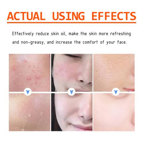 Salicylic Acid Clarifying Face Mask