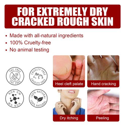 Exfoliating Foot Peel Mask with Salicylic & Malic Acid