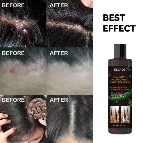 Herbal Scalp Shampoo with Mugwort & Honeysuckle