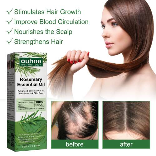 Rosemary Castor Hair Oil