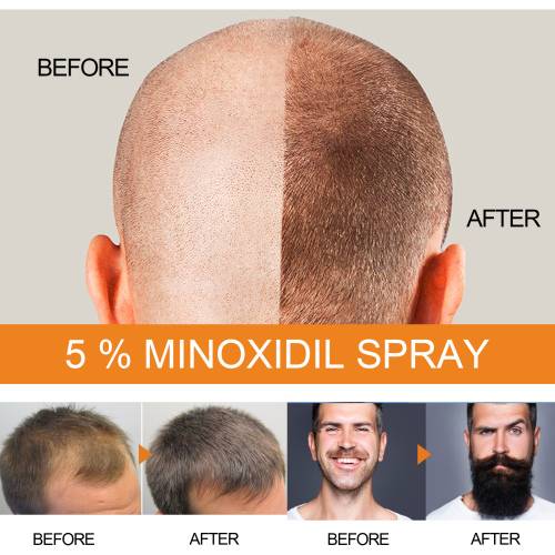 Men's Hair & Beard Spray