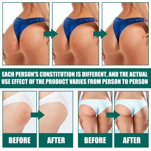 Butt Cream with Shea Butter, Clarifying