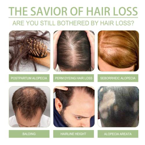 Herbal Scalp Oil with Ginger & He Shou Wu