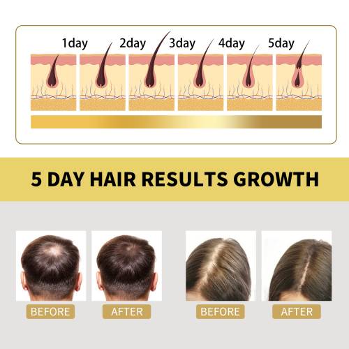Ginger Shampoo for Fuller-Looking Hair