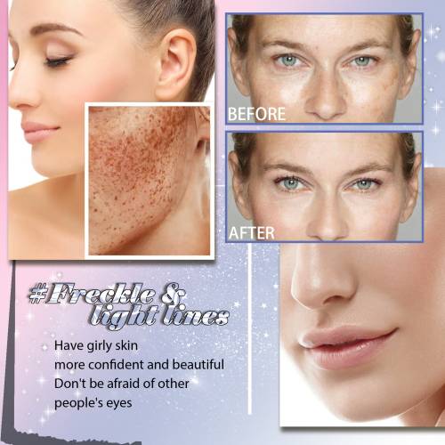Aloe & Turmeric Face Essence for Dark Spots & Fine Lines