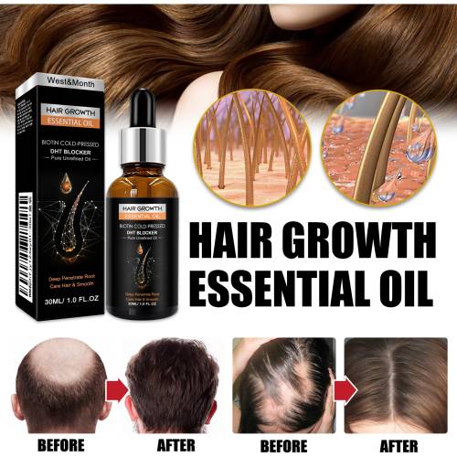 Ginger, Aloe & Castor Hair Oil