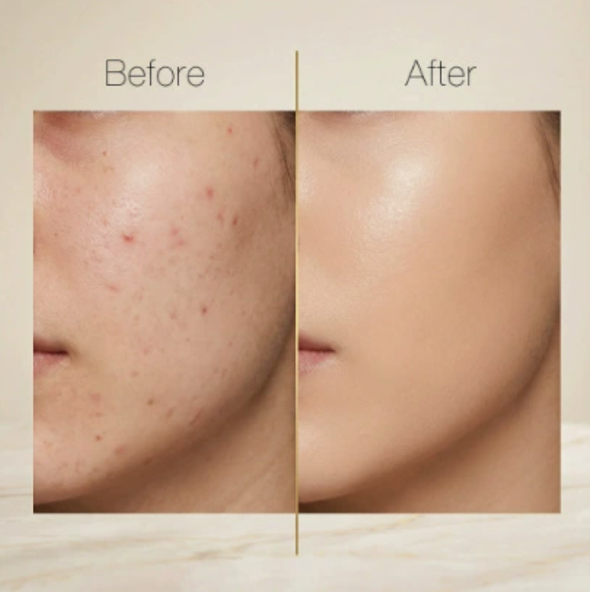 Lightweight Concealer, Natural Finish, Blendable Oil-Control Formula
