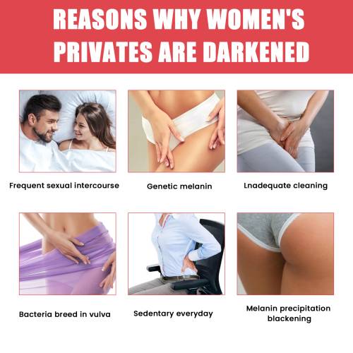 Arbutin Brightening Cream for Lips, Elbows & Knees, 50 ml