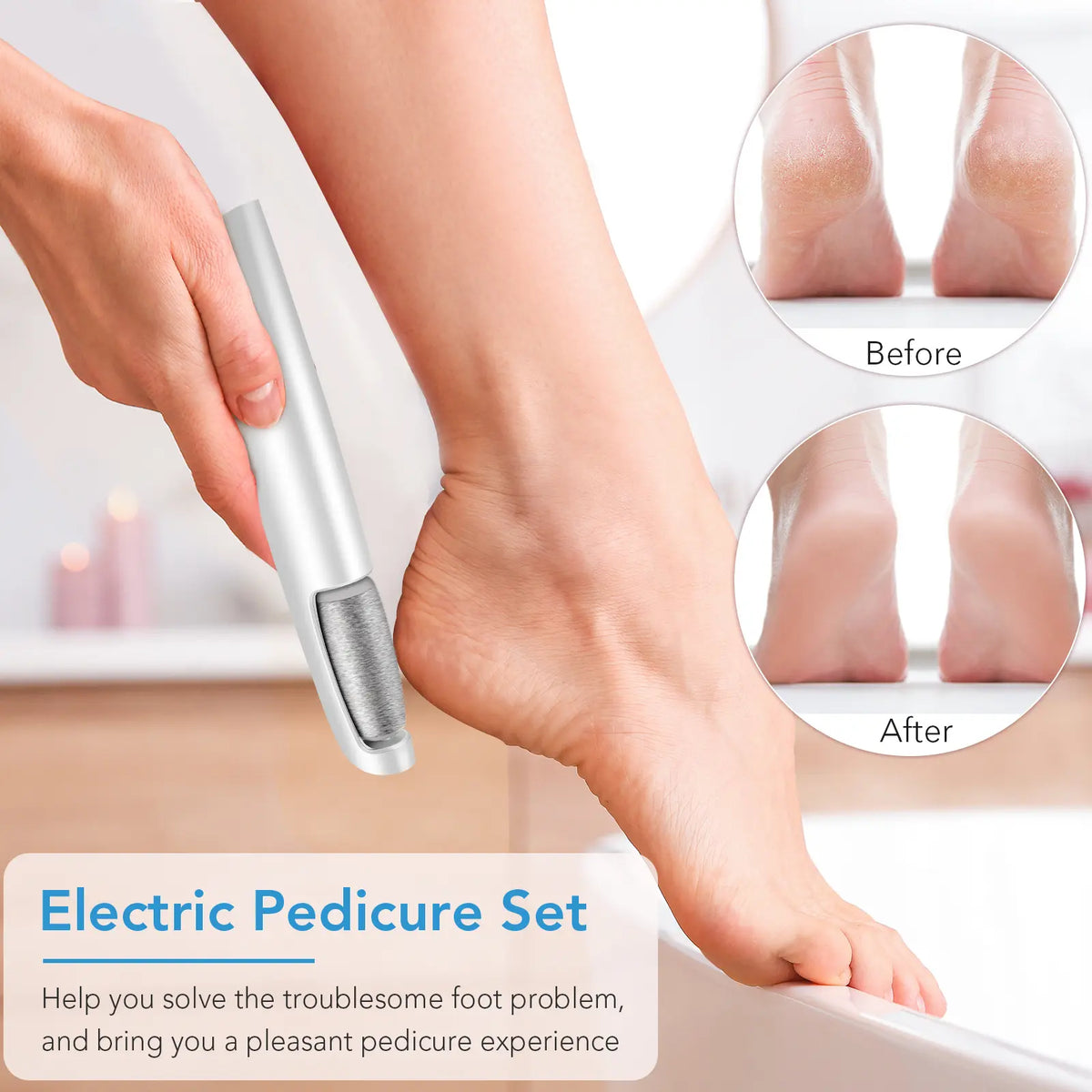 Electric Feet Callus Remover, Portable Foot File, Waterproof